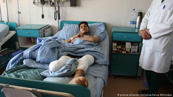  معاناة أفغان مصابين جنود سابقين - مستشفيات أفغانستان  Afghanische Kriegsverletzte  Soldaten leiden Krankenhäuser in Afghanistan Foto dpa