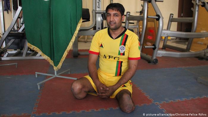  معاناة أفغان مصابين جنود سابقين - مستشفيات أفغانستان  Afghanische Kriegsverletzte  Soldaten leiden Krankenhäuser in Afghanistan Foto dpa